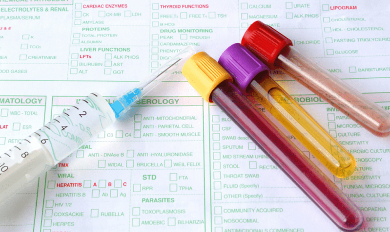options de diagnostic pour les parasites dans le corps